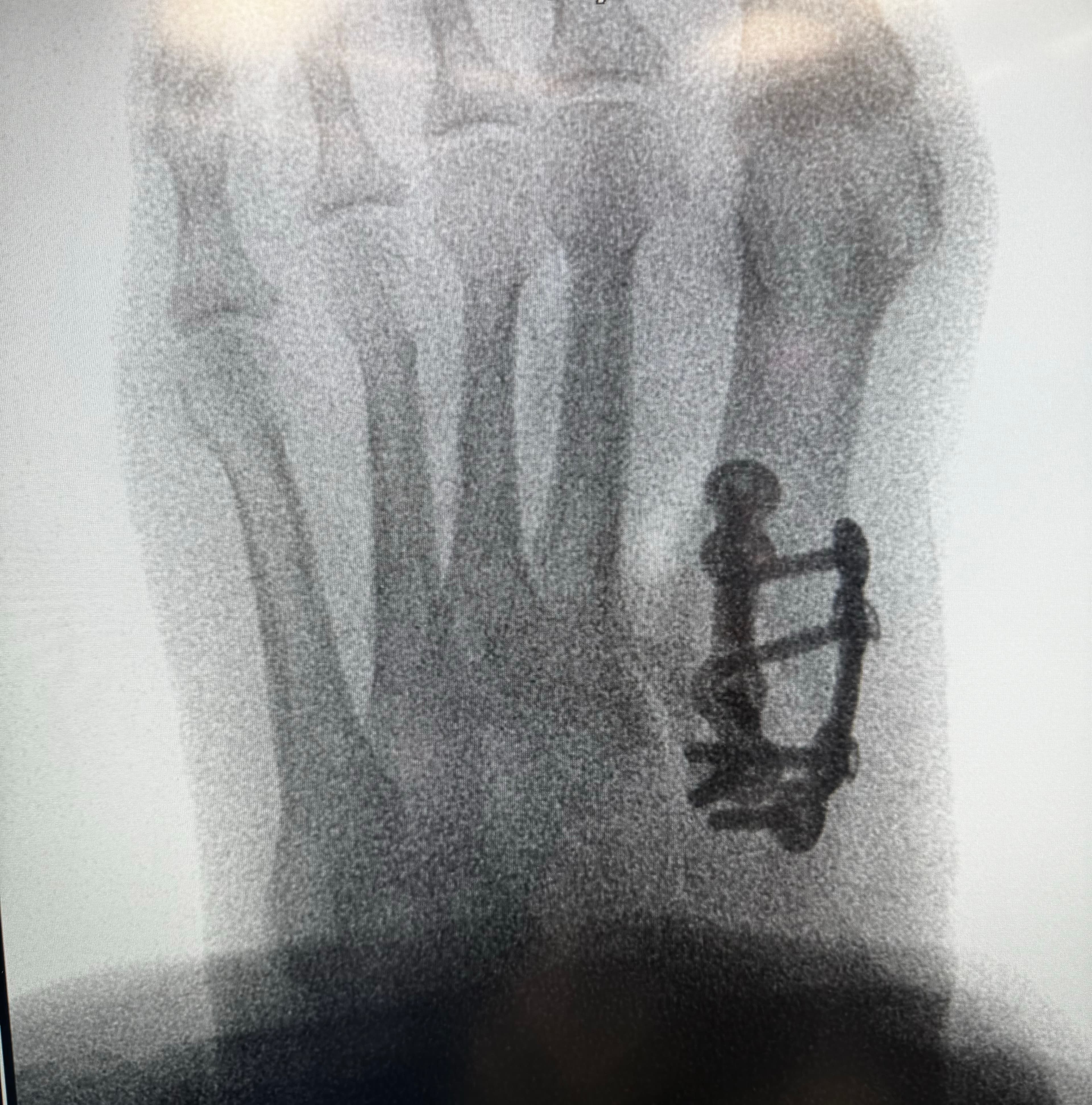 Digital X-ray imaging for foot and ankle diagnosis